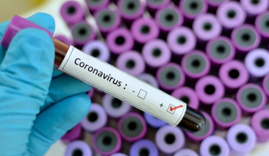 São Gonçalo tem dez mortes em decorrência do coronavírus 9 coronavírus