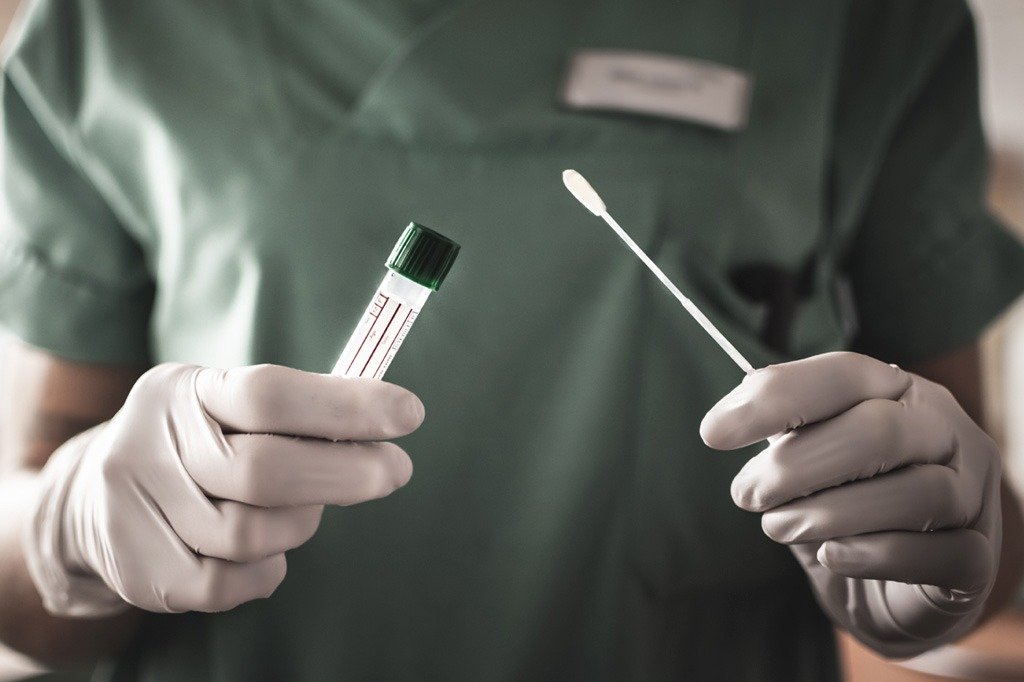 Maricá receberá 40 mil testes rápidos para Coronavírus 8 teste rapido covid