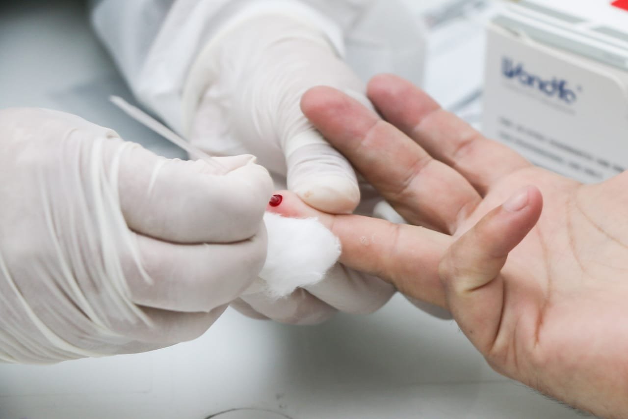 Maricá registra mais de oitenta casos de Covid-19 nesta terça-feira (16) 6 teste rapido covid marica
