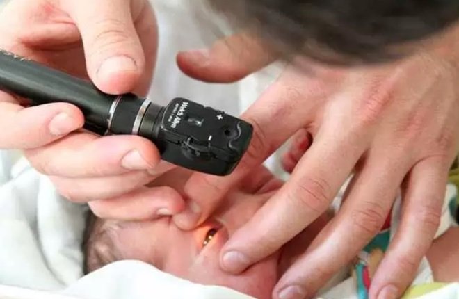 Maricá poderá ter teste do olhinho em recém-nascidos 8 teste do olhinho
