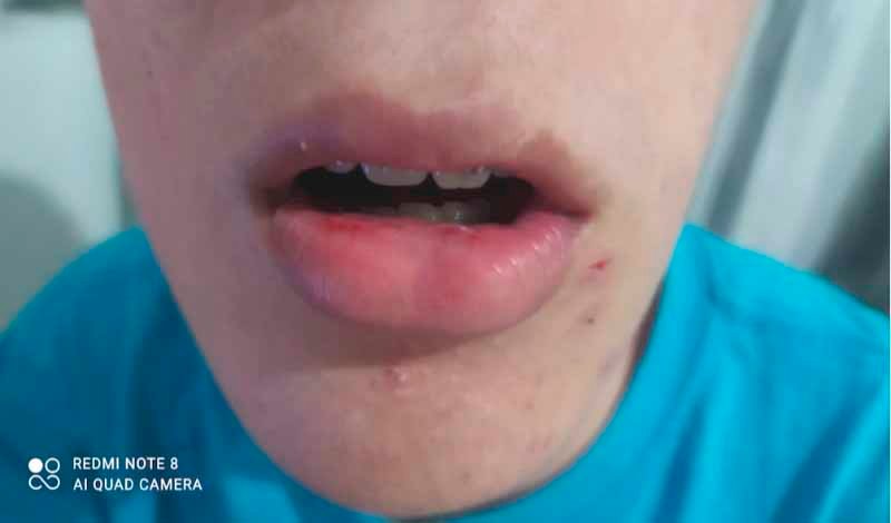 Adolescente autista é agredido dentro de ônibus em Maricá 8 adolescente autista agredido copiar