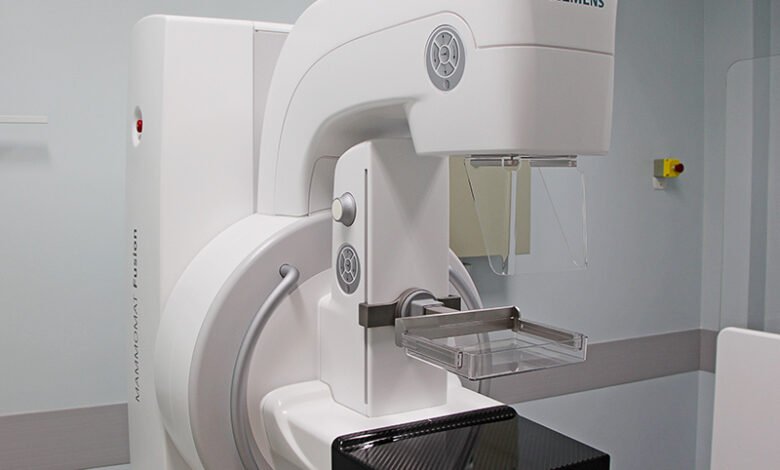 Maricá compra novo mamógrafo para ampliar dignósticos 9 mamografo