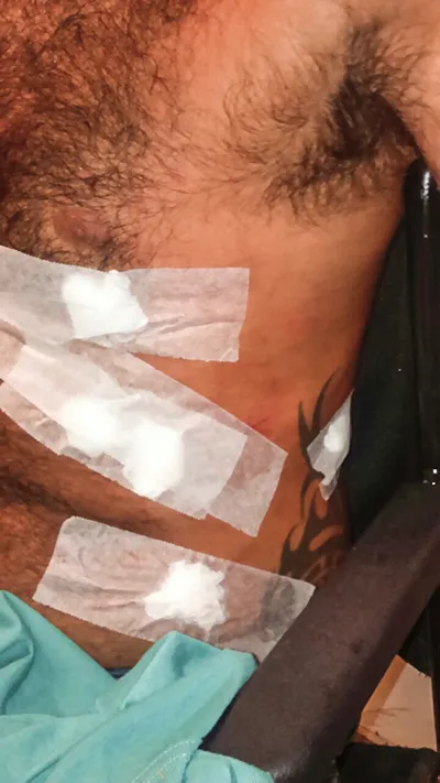 Homem é internado após sofrer agressão em Maricá 10 Homem ficou ferido no peito, tórax e na cabeça.