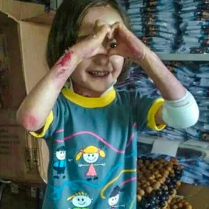 Maricá terá festa beneficente para menina de 5 anos com doença rara 7 Raíssa Victória, de 5 anos, nasceu com doença rara.