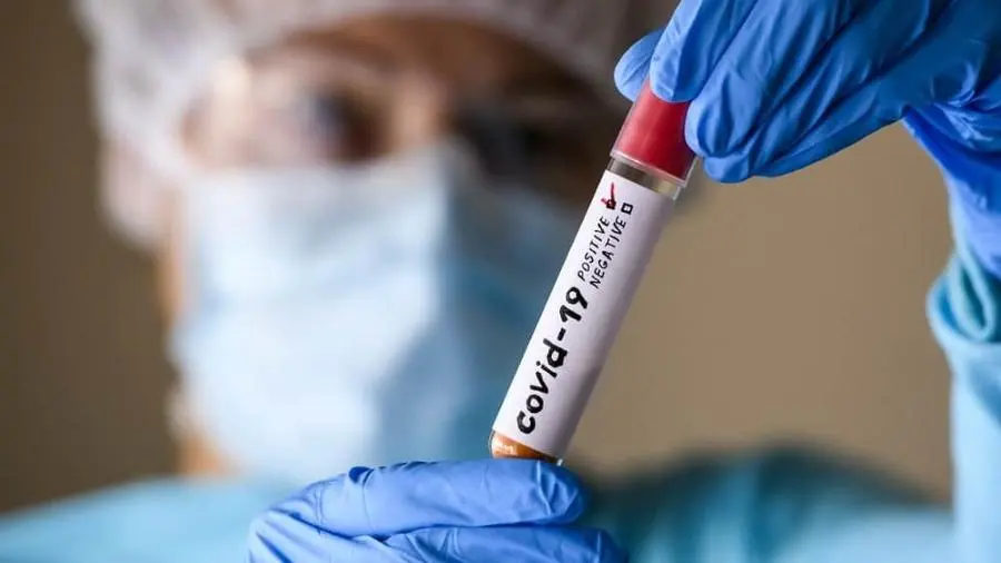 RJ: Saúde do estado muda metodologia para atualizar casos de COVID-19 9 covid19