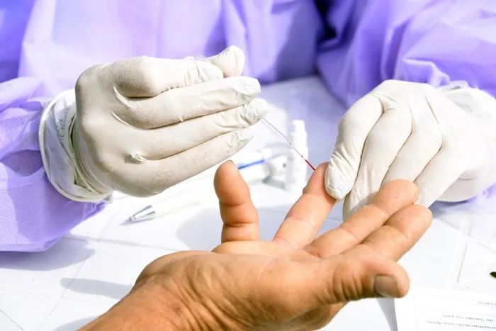Maricá: Taxa de positividade de testes para Covid-19 sobe pra 39% 12 covid teste marica rj