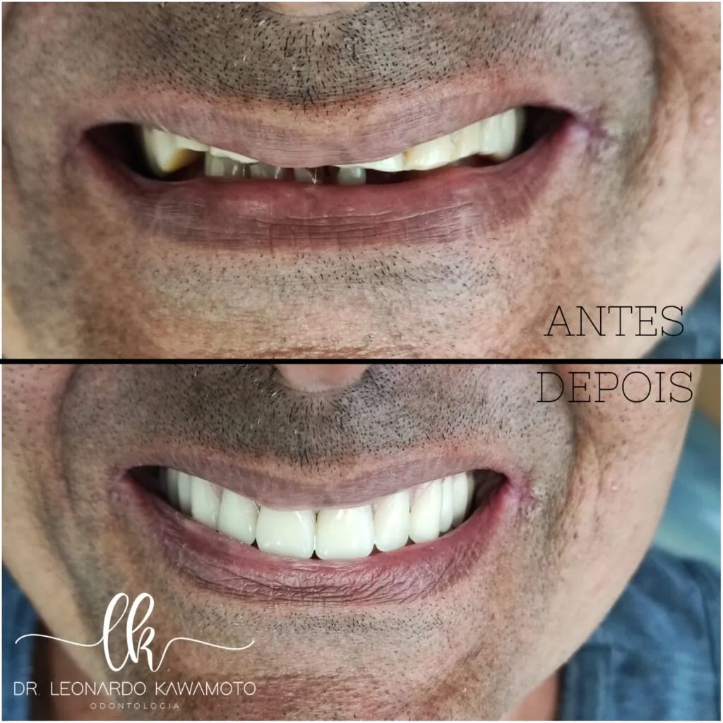Clínica Dr. Leonardo Kawamoto: Transformando Sorrisos e Restaurando a Confiança 10 clinica leonardo kawamoto 2