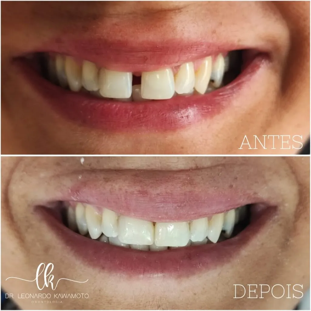 Clínica Dr. Leonardo Kawamoto: Transformando Sorrisos e Restaurando a Confiança 9 clinica leonardo kawamoto an